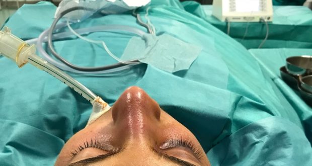 Siracusa, subisce un pugno: 14enne operato al volto