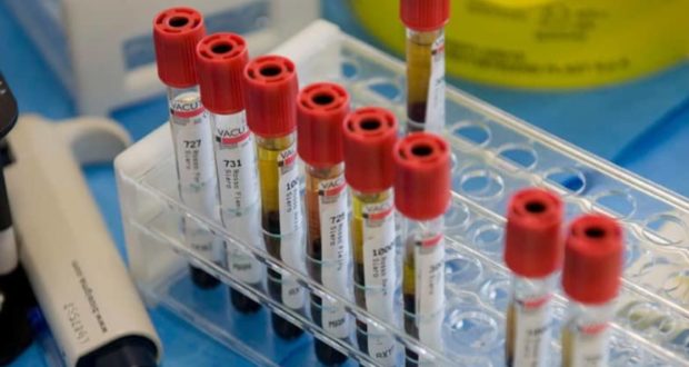 La Federazione Sanità della Cidec: i laboratori di analisi cliniche coinvolti con il Servizio sanitario