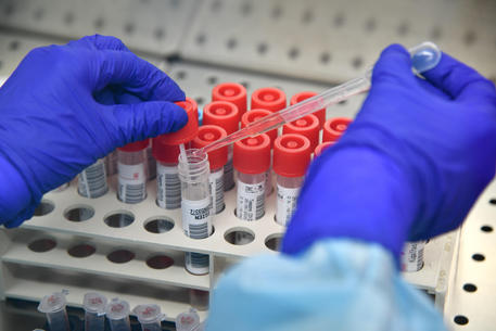 Coronavirus:in Sicilia 39 nuovi casi, 28 sono migranti