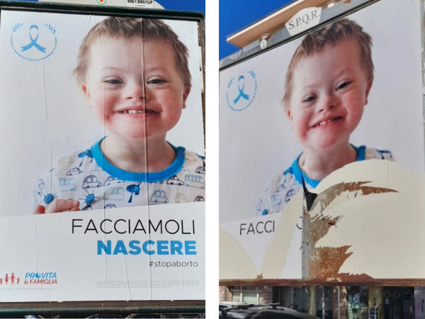 Giornata Sindrome Down. Pro Vita Famiglia: Bambini vanno fatti nascere, non eliminati