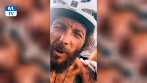 Jovanotti cade dalla bici e si rompe clavicola e femore: la reazione di dolore del cantante