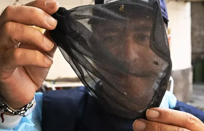 Caso di West Nile a Messina, la paziente ricoverata nell’ospedale Papardo