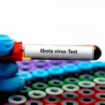 La Regione siciliana pronta per eventuale rischio Ebola