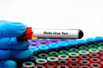 La Regione siciliana pronta per eventuale rischio Ebola