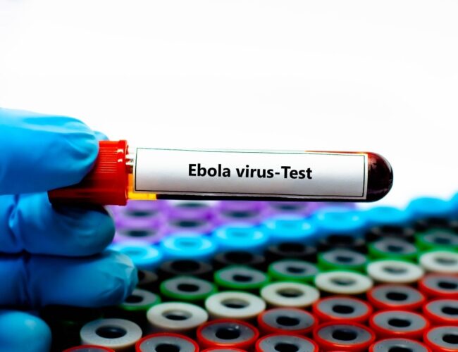 La Regione siciliana pronta per eventuale rischio Ebola