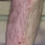 Scoglitti, incidente dalla passerella: precipita persona con disabilità. Cresce l’allarme su sicurezza e accessibilità