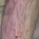 Scoglitti, incidente dalla passerella: precipita persona con disabilità. Cresce l’allarme su sicurezza e accessibilità
