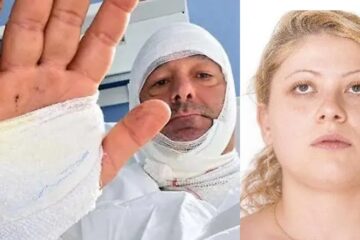 Aggressione con acido all’avvocato Broccio: convalidato il fermo, Maria Grazia Messina resta in carcere