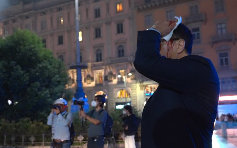 Milano, parla il dirigente di polizia ferito in piazza Duomo: «Incontrato un’ondata di violenza inaudita»
